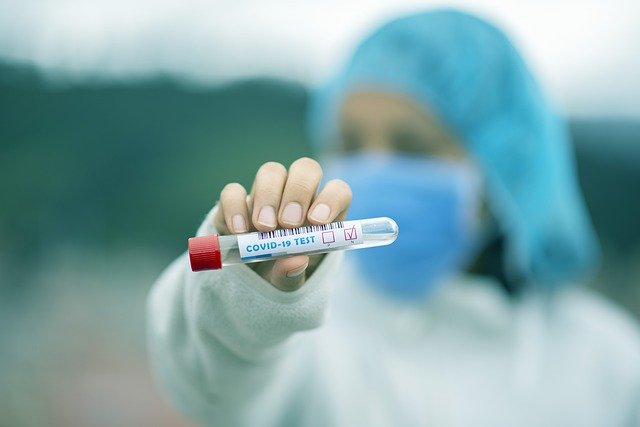 Virólogo alemán duda sobre efectividad de pruebas covid de antígenos