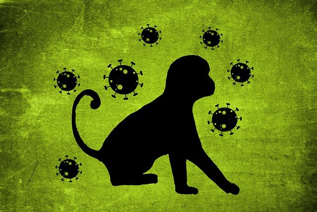 Número confirmado de casos de viruela del simio en Alemania llega a 21