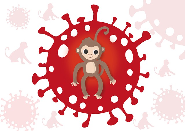 Alemania confirma primer caso de viruela del simio en un niño